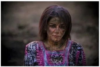 گریم جلوه ویژه — آسیبدیدگی